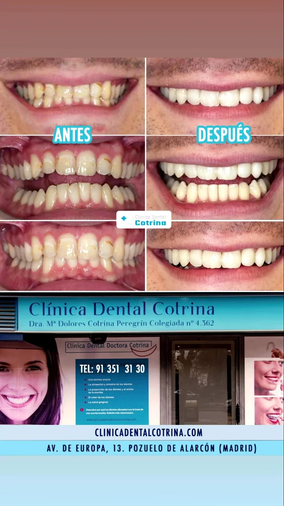Clínica Dental Doctora Cotrina Dentistas en Pozuelo de Alarcón. - 3