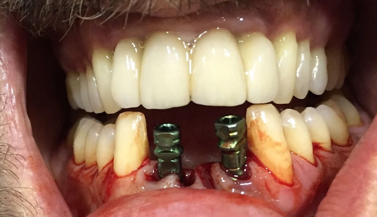Clínica Dental Dr. Escalante - 2