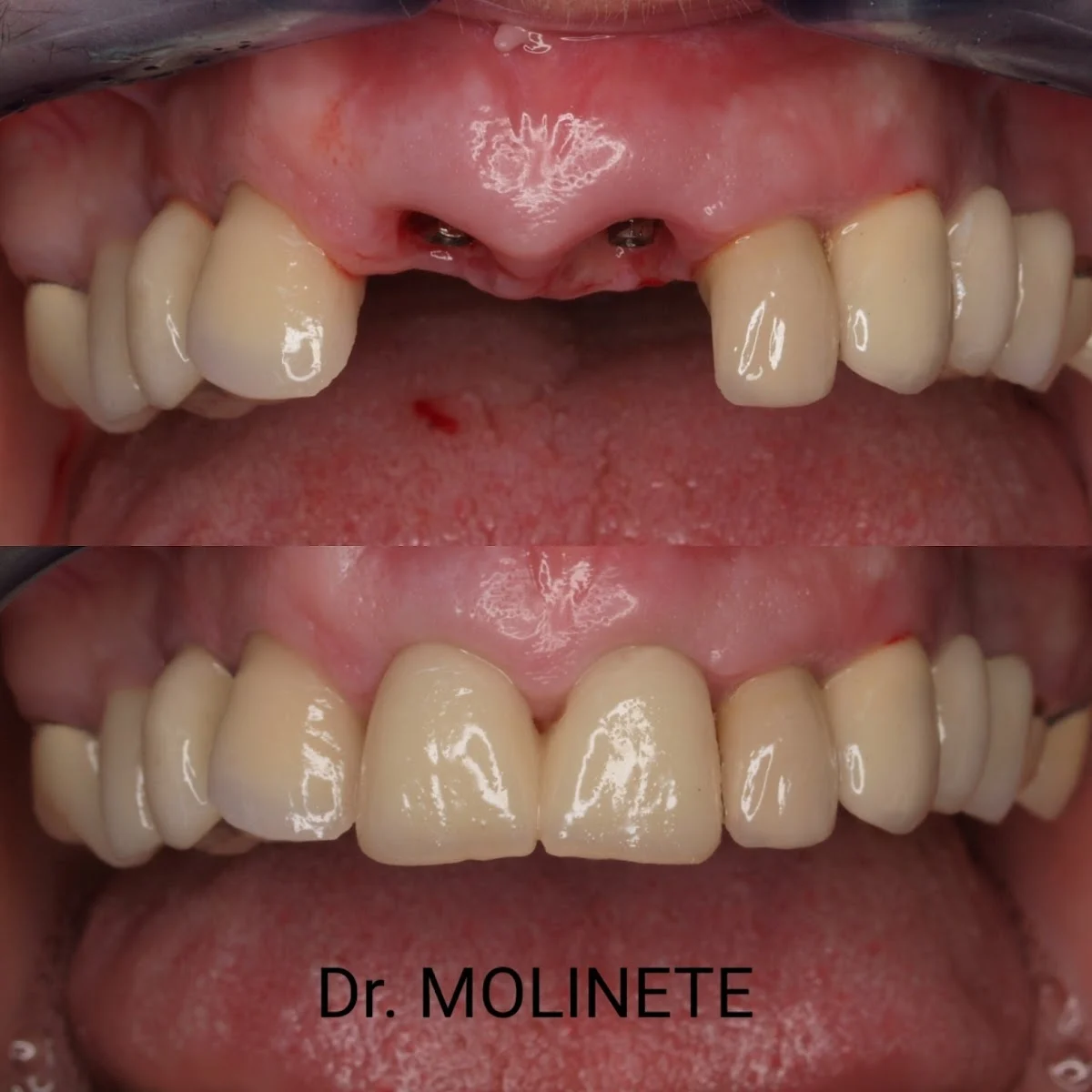 Clínica Dental Dr. Molinete - 4