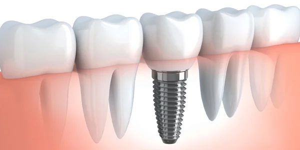 Clinica Dental Dr. Rene Rojas Serrano - 2