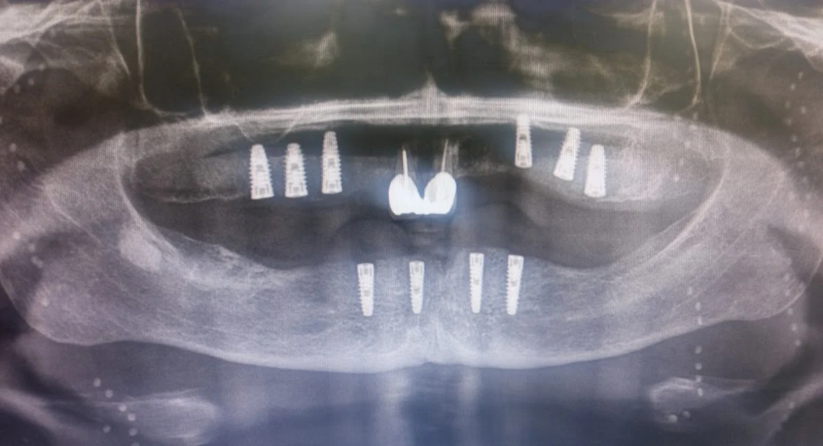 Clínica Dental Dr. Víctor Granda. Dentista en Avilés . - 2