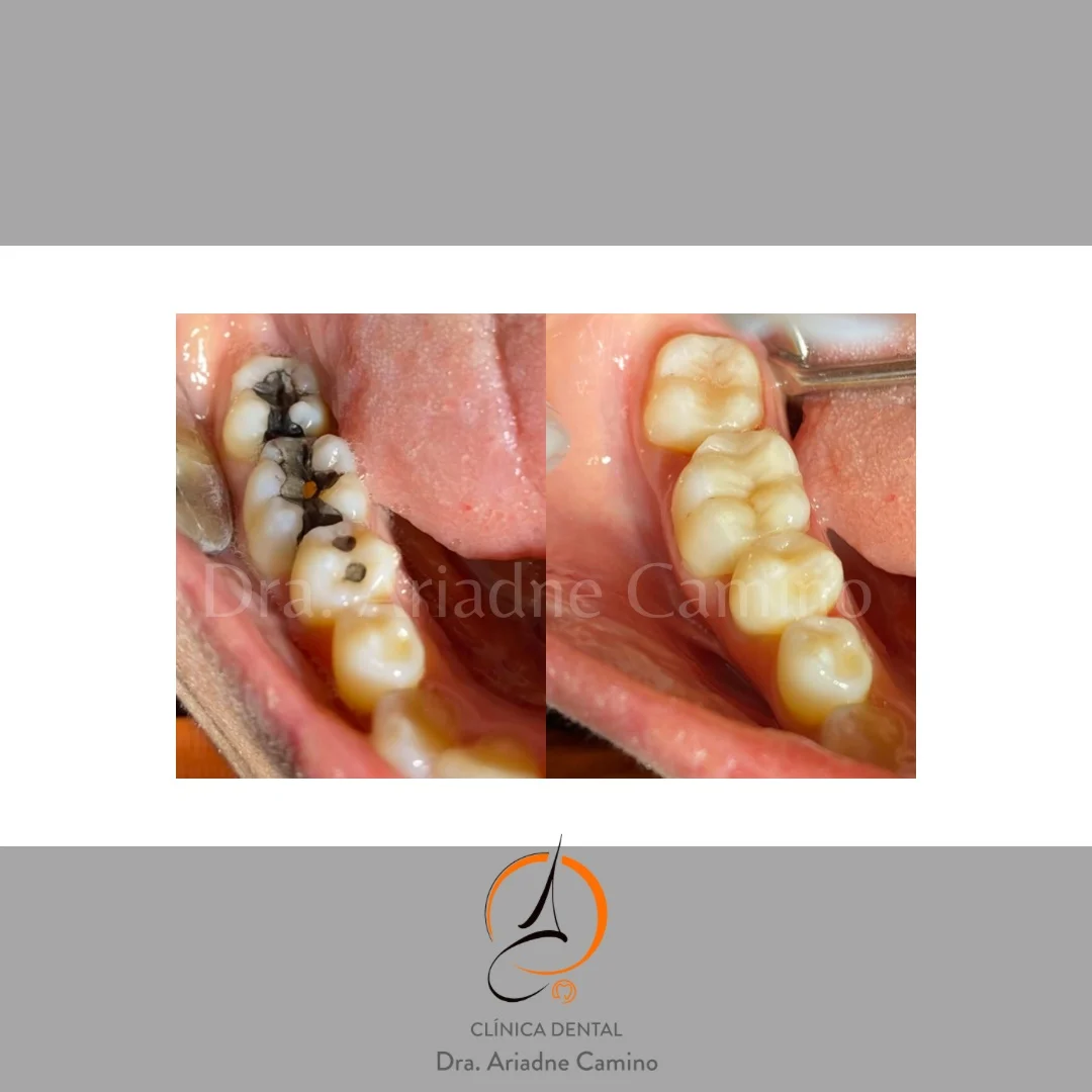 Clínica Dental Dra. Ariadne Camino - 2