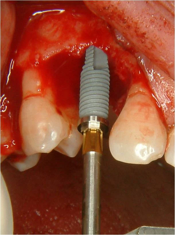 Clínica dental Dra. Karina Pérez - 4