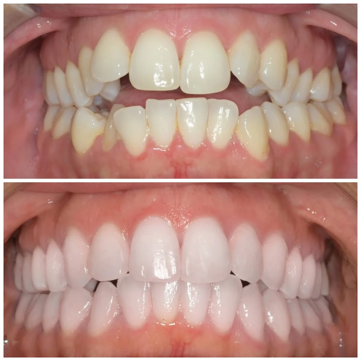 Clínica Dental Dra. León Pozuelo - Dentistas, ortodoncia, implantes dentales - 2