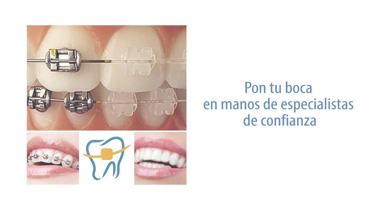 Clínica dental en Alcalá de Henares | Sonrisa Amiga - 2