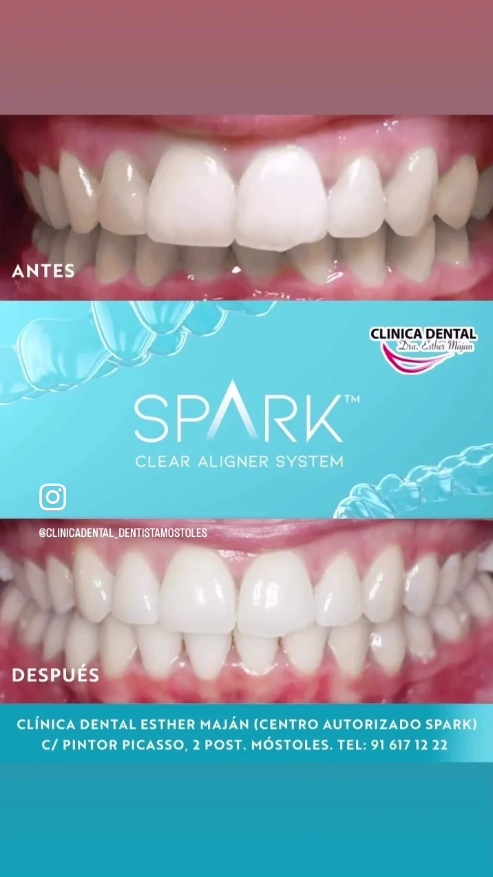 Clínica Dental en Móstoles Esther Maján Dentistas Odontólogos Tratamientos Dentales EconómicosOferta - 2