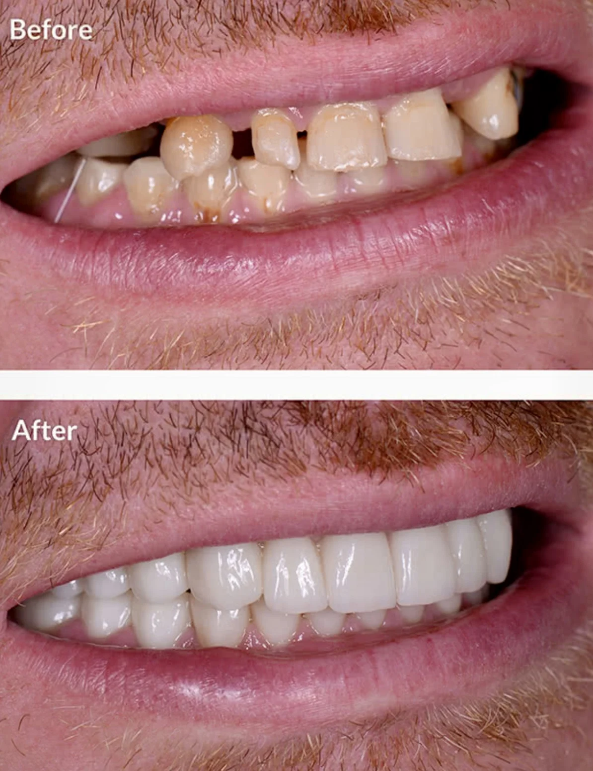 Clínica Dental en Móstoles Prodontia Dra. Gabriela Amador, Dentista, Ortodoncia Invisible, Niños, Implantes, Apnea del sueño - 2