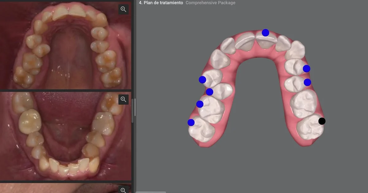 Clínica Dental en Móstoles Prodontia Dra. Gabriela Amador, Dentista, Ortodoncia Invisible, Niños, Implantes, Apnea del sueño - 3