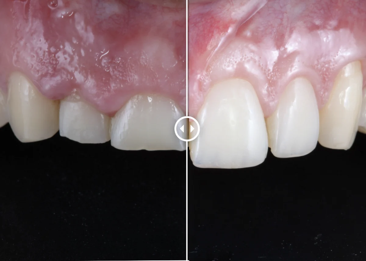 Clínica Dental Franch-Adriaens Odontología Avanzada - 2