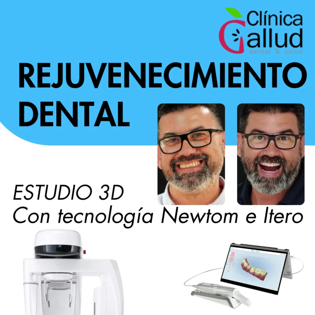 Clinica Dental Gallud