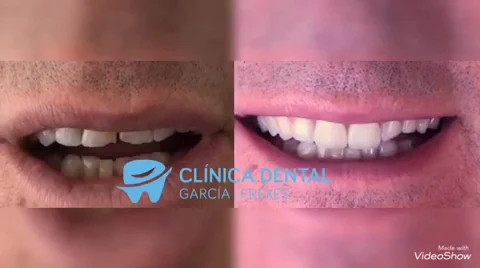 Clínica Dental García Frexes - Gandia - 2