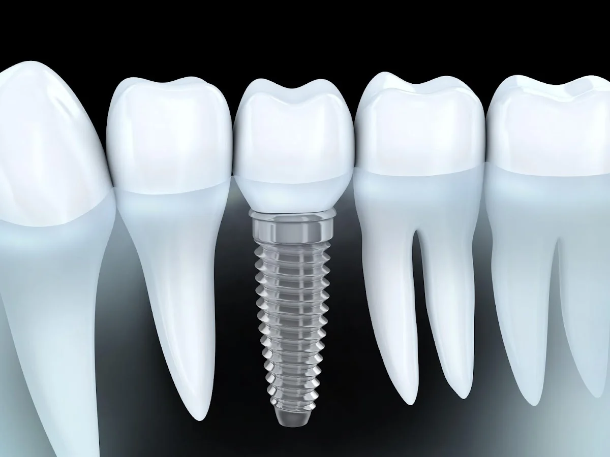 Clínica Dental Garraf. Grup Vithas - 2