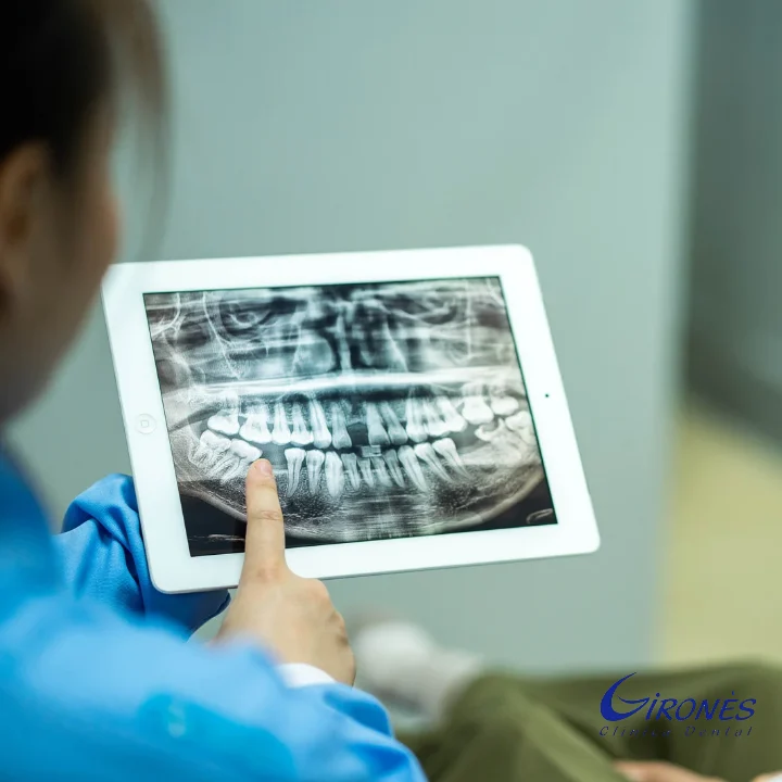 Clínica Dental Gironès - Salt - 3