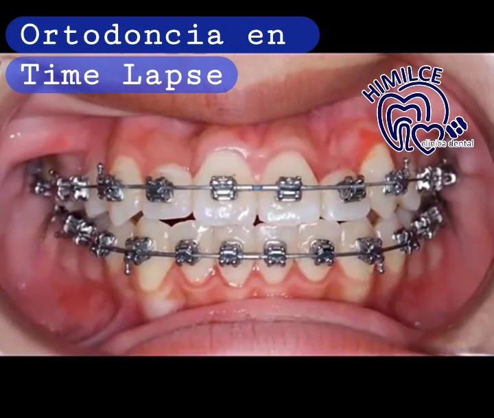 Clínica Dental Himilce