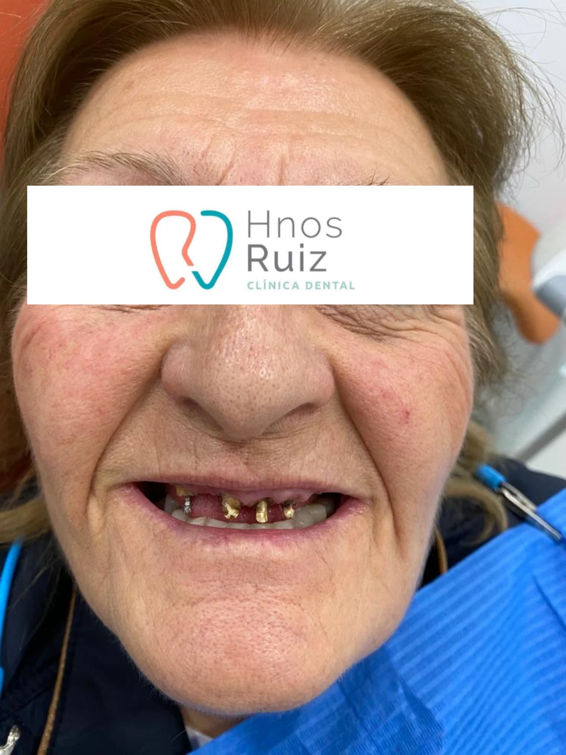 Clínica Dental Hnos Ruiz - 2