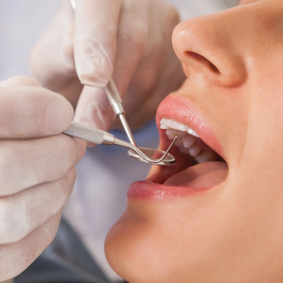 CLINICA DENTAL ILLESCAS - ORTODONCIA - IMPLANTES - AMERICA