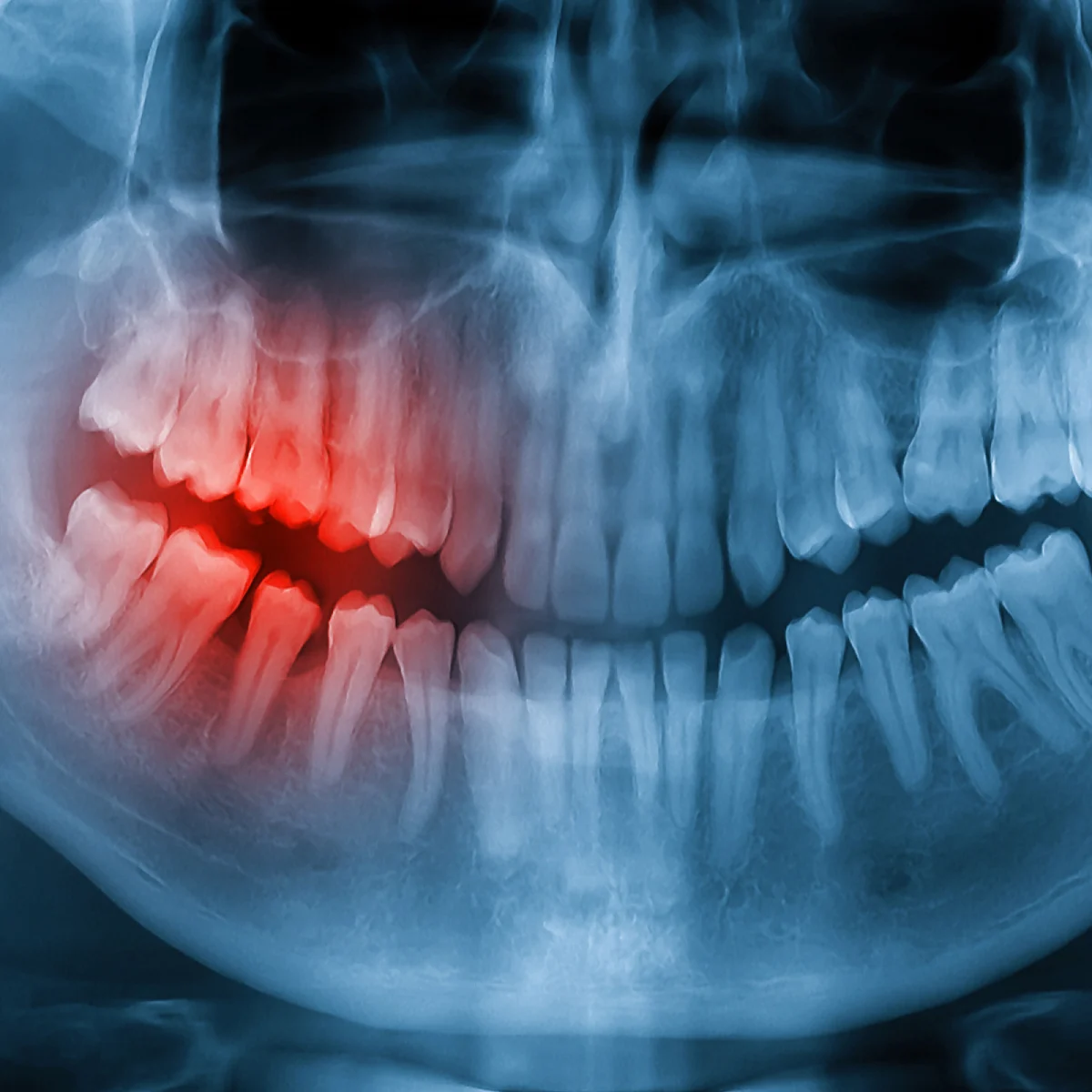 CLINICA DENTAL ILLESCAS - ORTODONCIA - IMPLANTES - AMERICA - 2