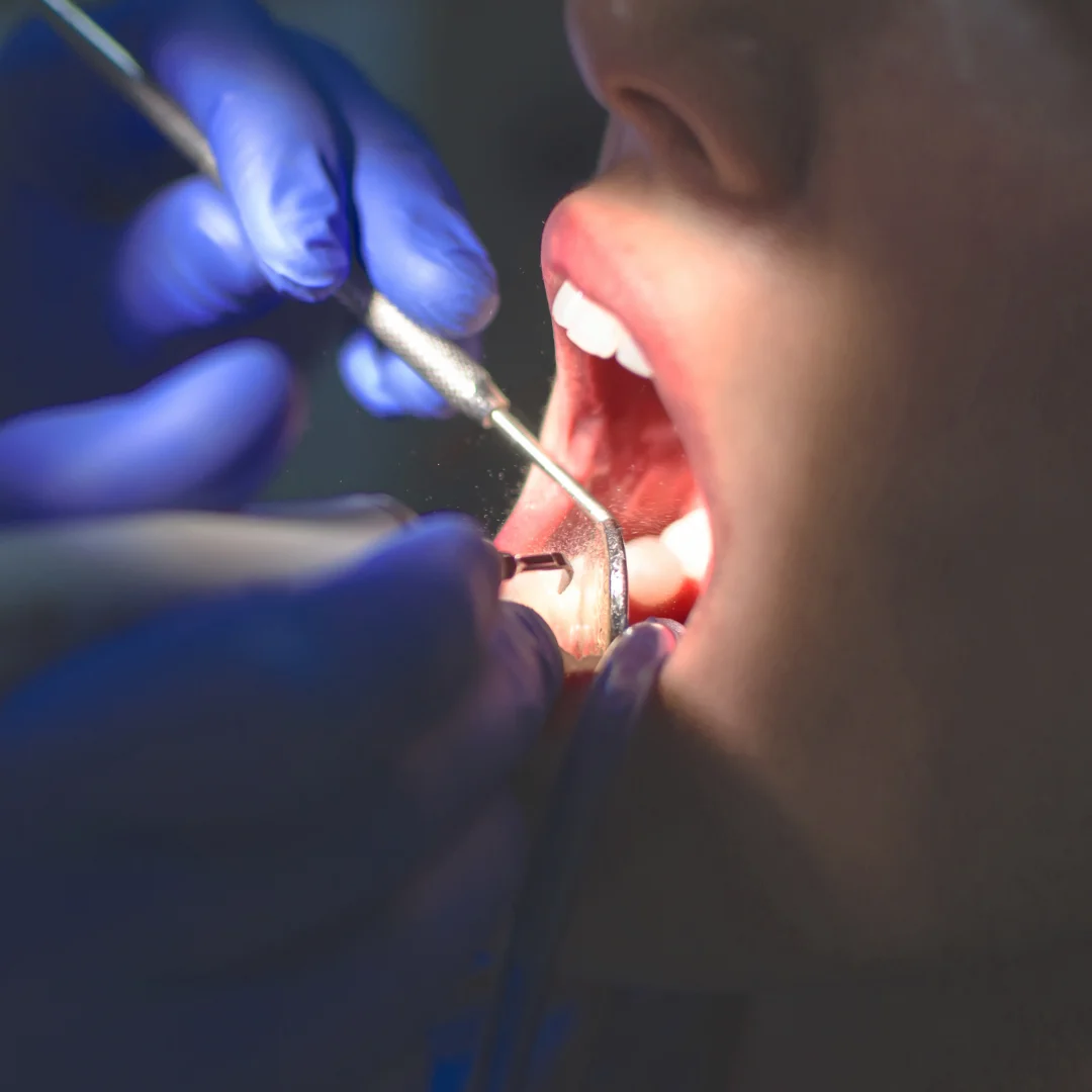 CLINICA DENTAL ILLESCAS - ORTODONCIA - IMPLANTES - AMERICA - 3