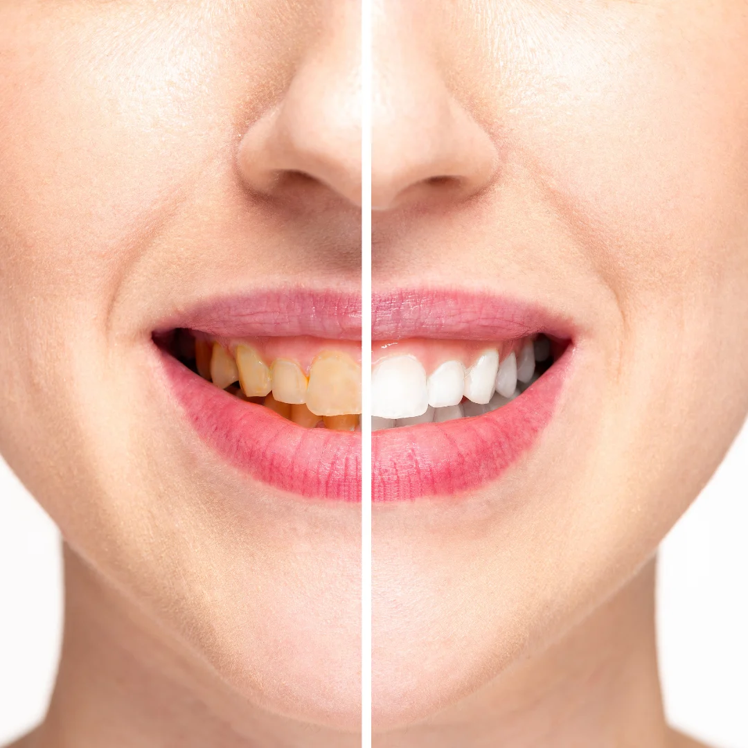 CLINICA DENTAL ILLESCAS - ORTODONCIA - IMPLANTES - AMERICA - 4
