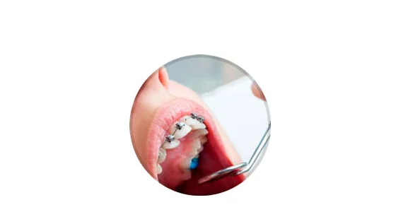 Clínica Dental Impala