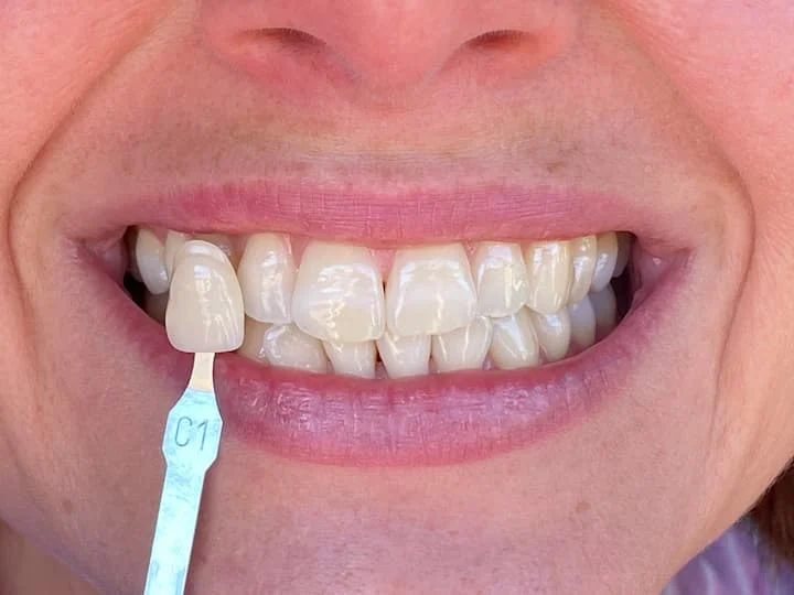Clinica Dental IMPLANTA - 2