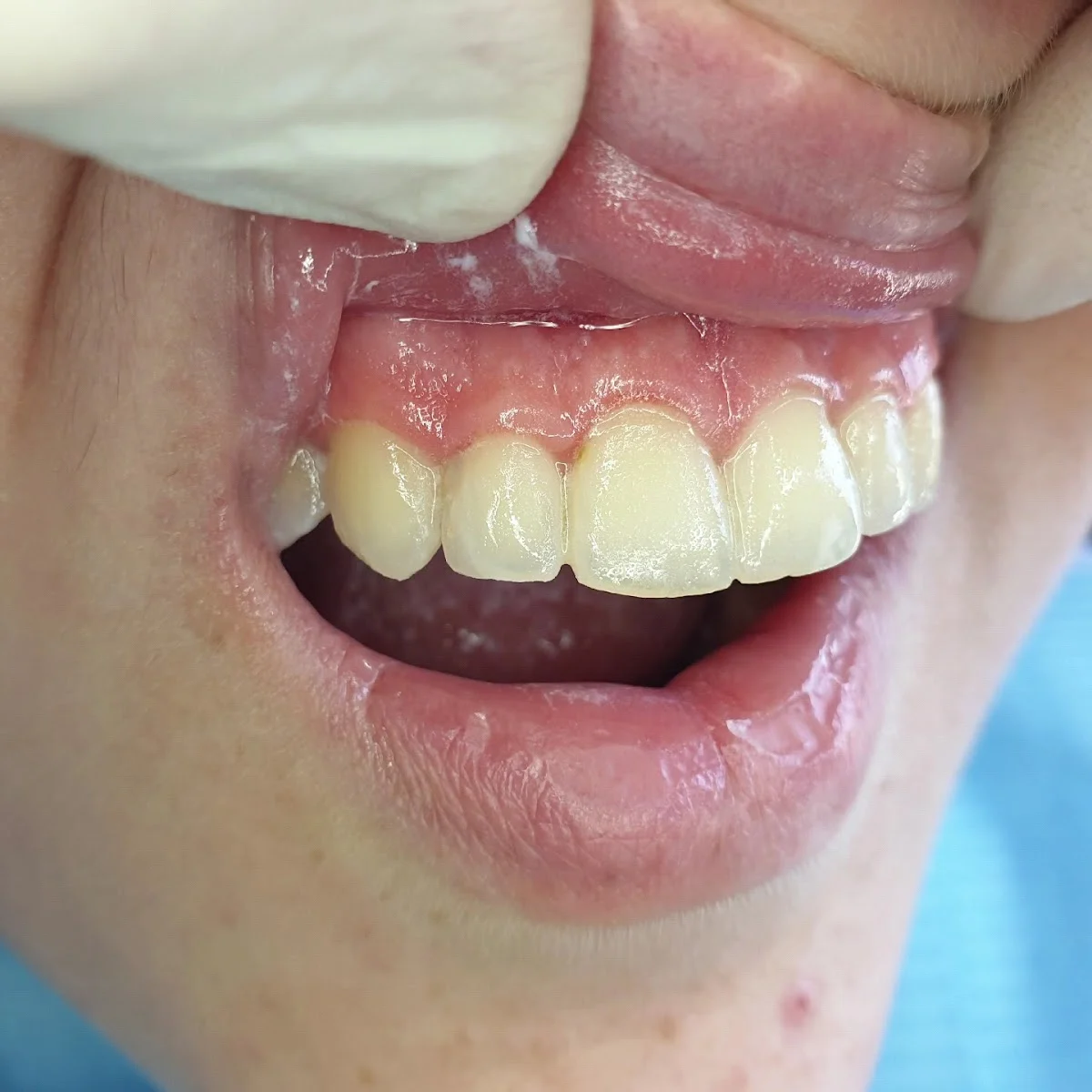 Clínica Dental Juan Bouthelier Almozara - 4