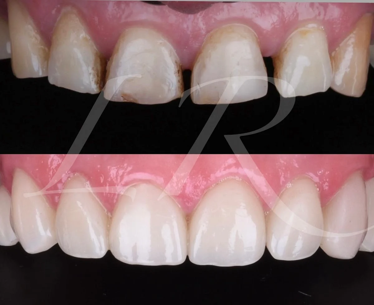 CLINICA DENTAL LARA RUIZ - 3