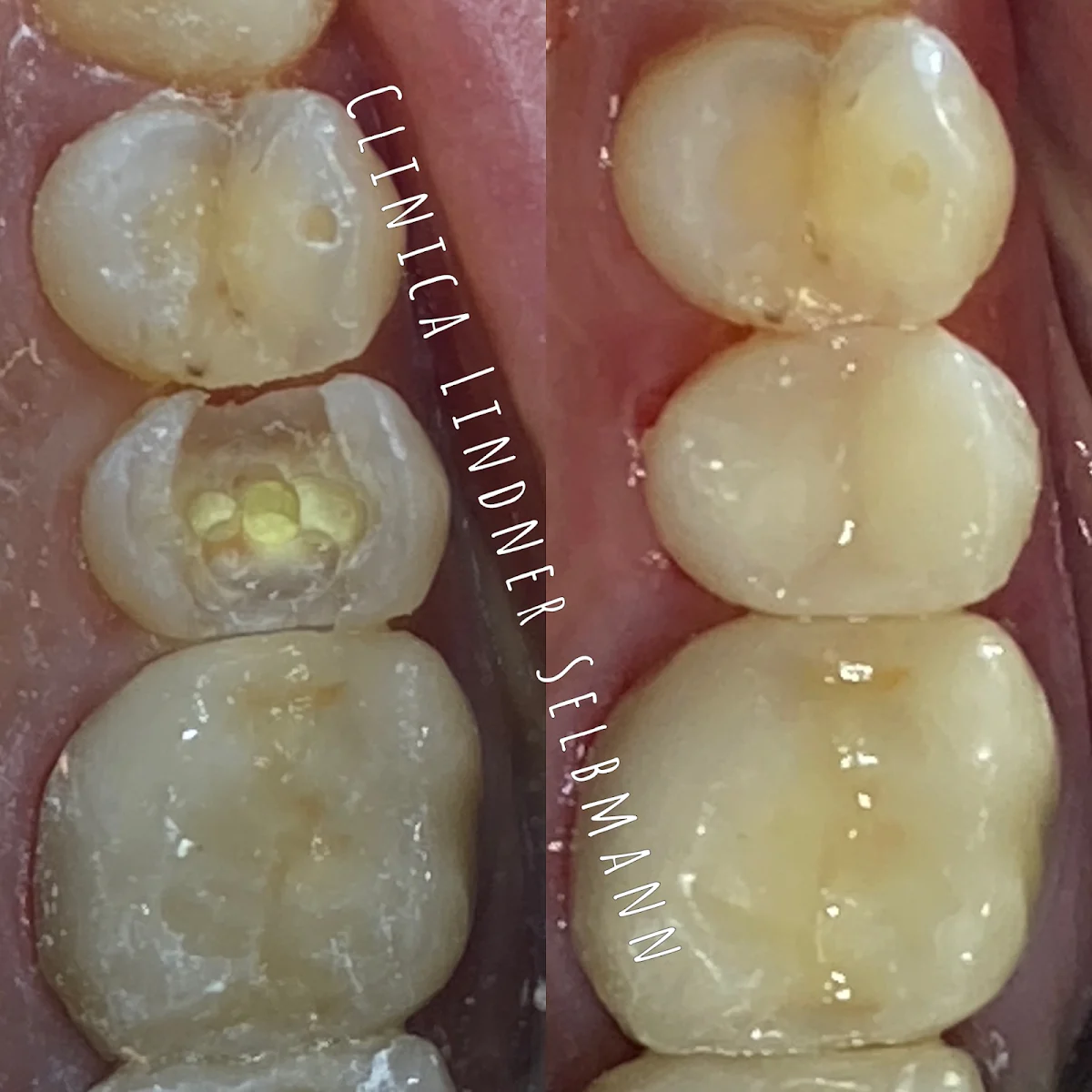 Clinica Dental - Lindner Selbmann - 2