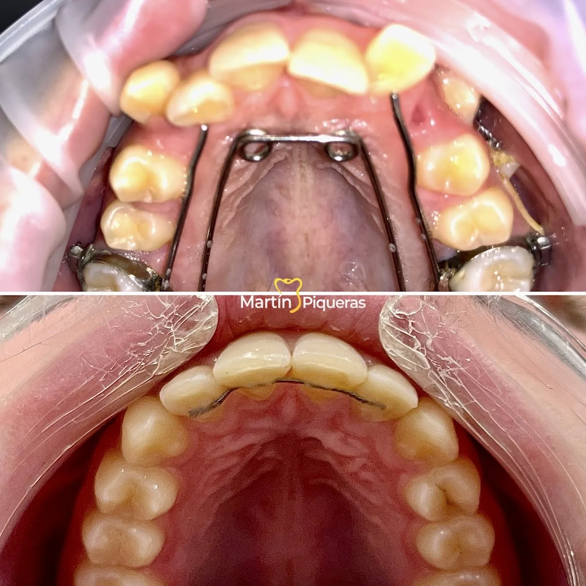 CLINICA DENTAL MARTÍN PIQUERAS - MYPDENTAL - 2