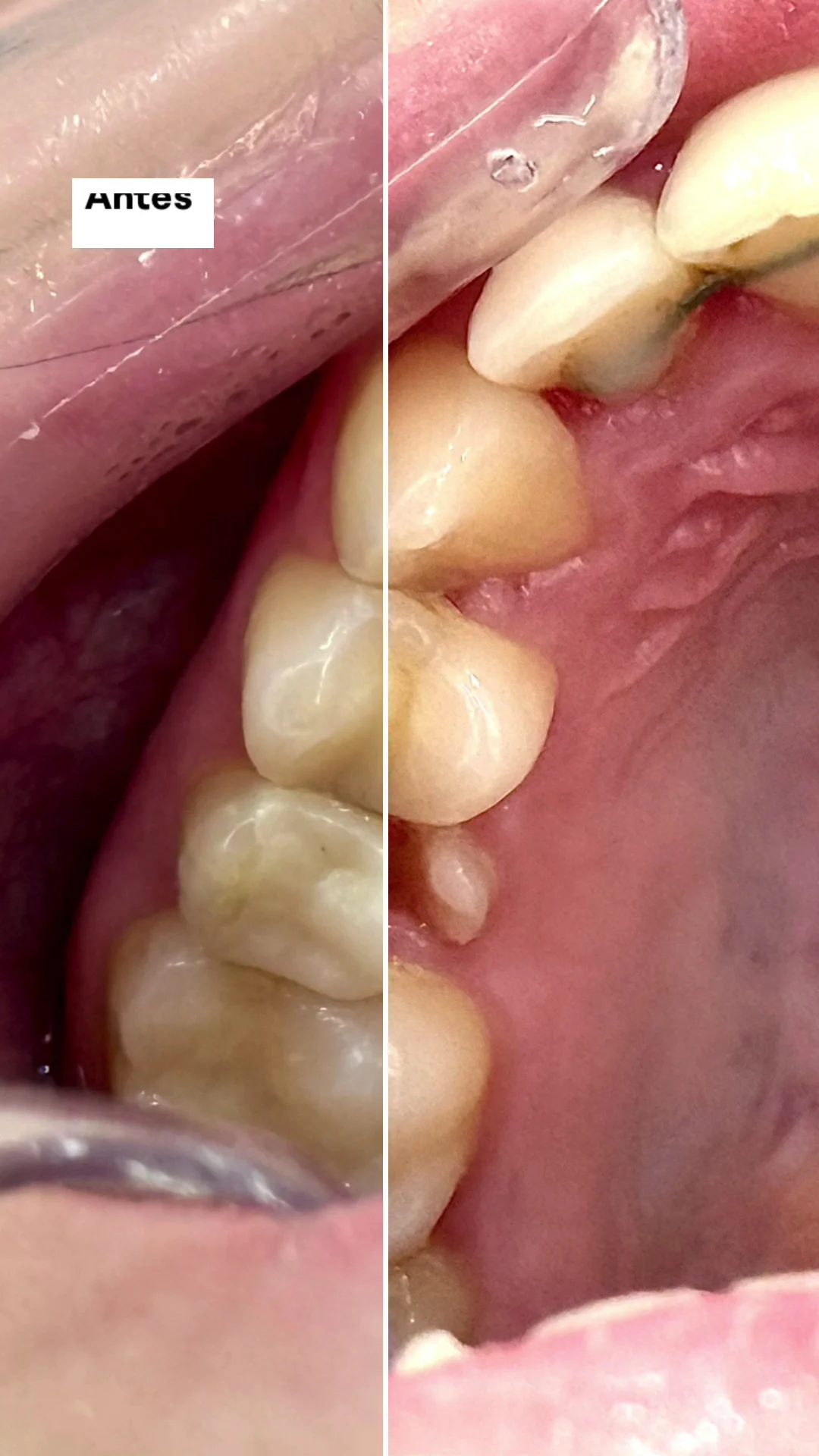 CLINICA DENTAL MARTÍN PIQUERAS - MYPDENTAL - 3