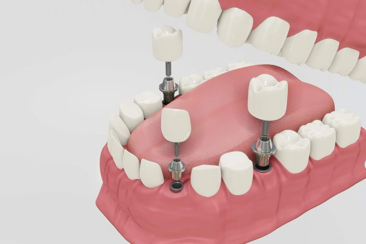 Clínica Dental Miguel Angel Giannasi