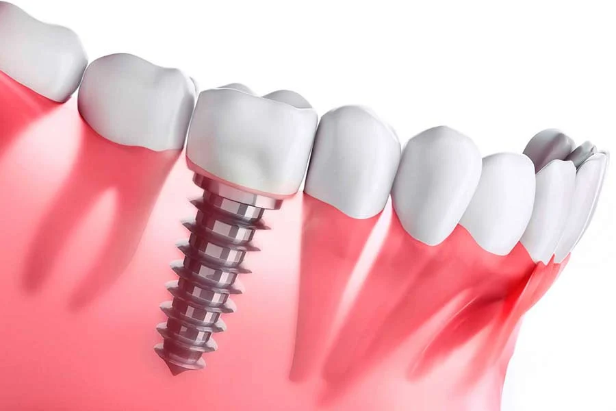 Clínica Dental MUNDISALUD - 2