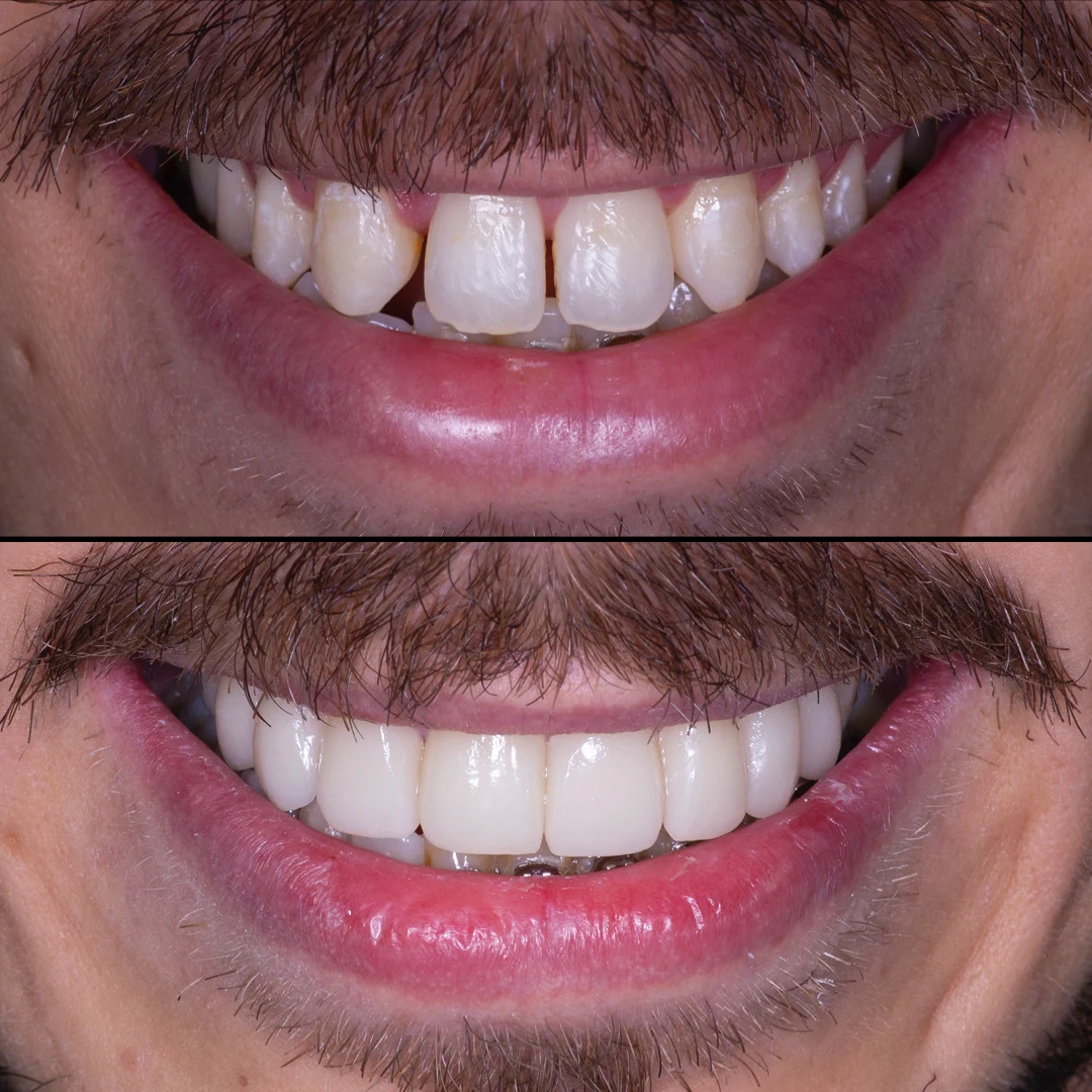 Clínica Dental Nagua Cáceres - 2