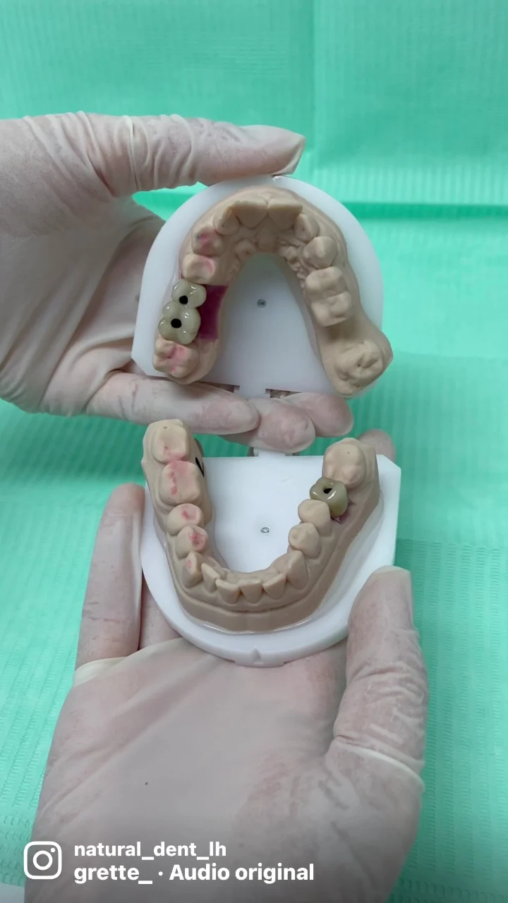 Clínica Dental NATURAL DENT Dra.Montse Granollers i Equip - 3
