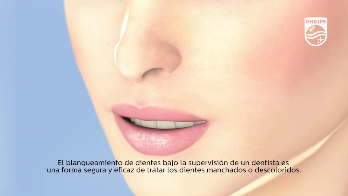 Clínica Dental Noelia Ródenas - Invisalign Murcia - 2