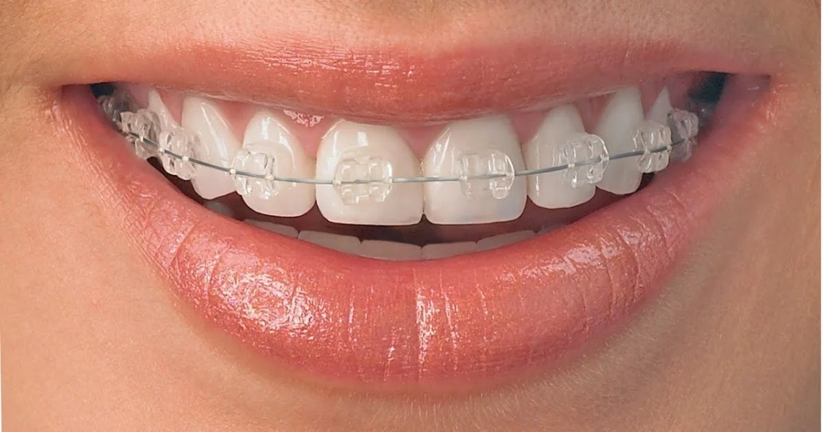 Clínica Dental Om. Dra. Elizabeth Romano - 2