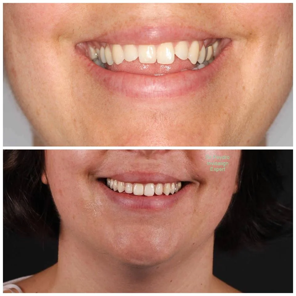 Clínica Dental Peydro Herrero - 2