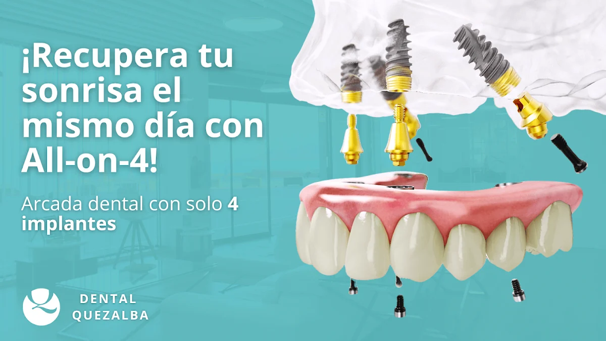 Clínica Dental Quezalba - Dentista en Lomo los Frailes - 2