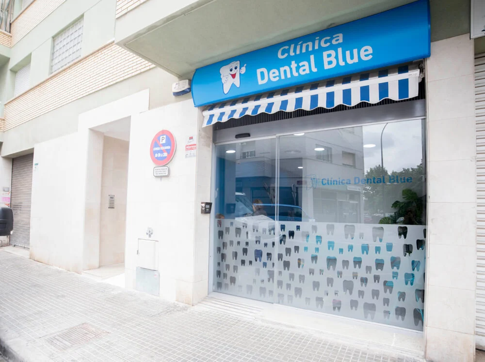 Clínica Dental Reus - Clínica Dental Blue