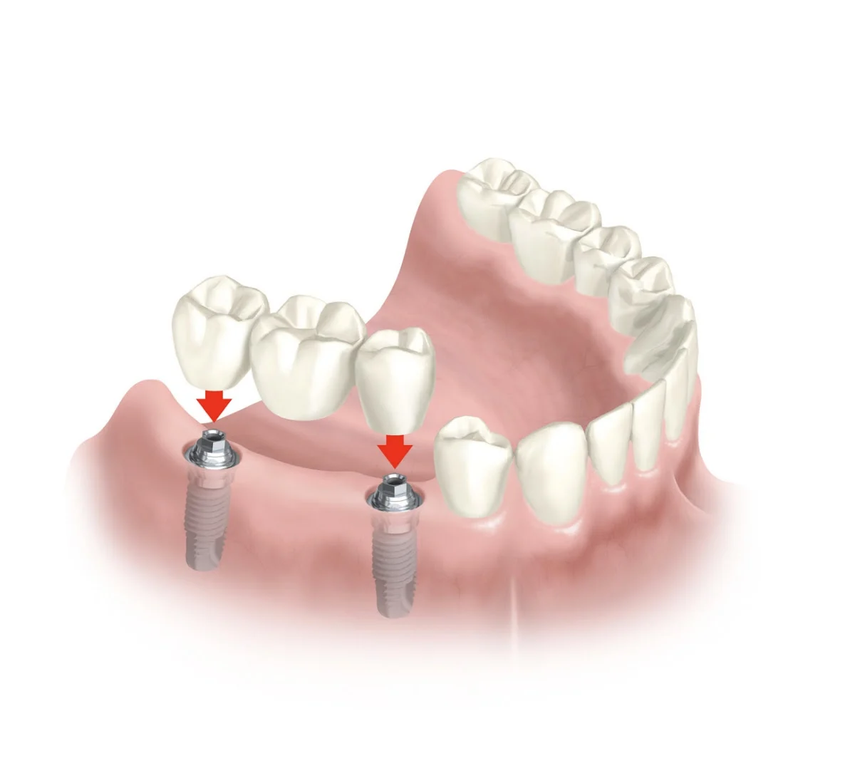 Clinica Dental Riera - 3