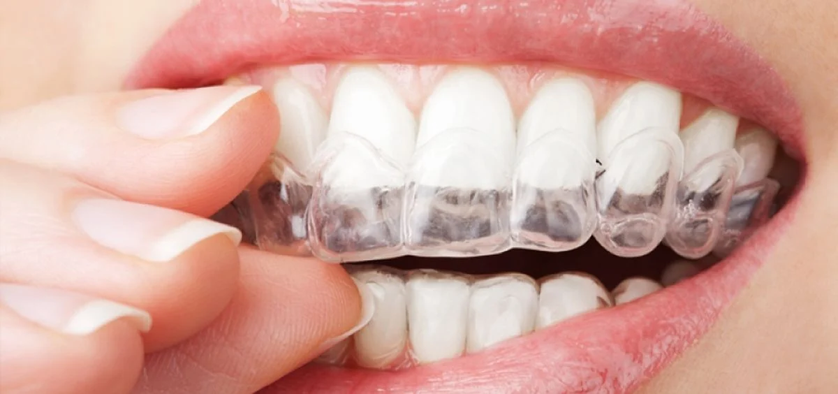 Clinica Dental Rivera Bindon