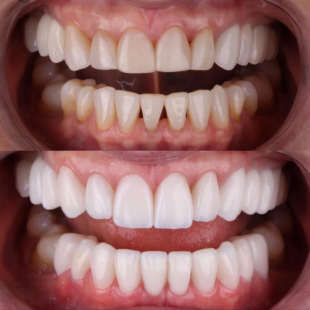 Clínica Dental San Magno | Expertos Estética Dental | Ortodoncia Invisible - 3