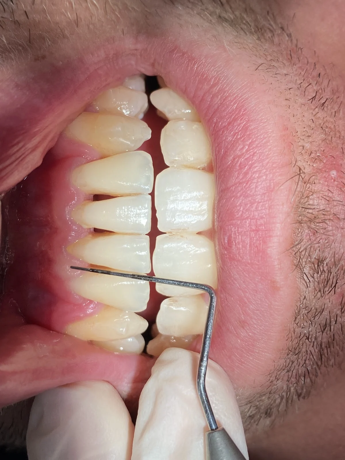 Clínica DentAl Sant Joan Despí - 2
