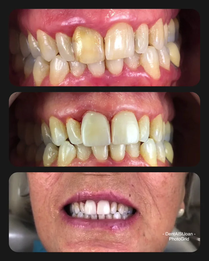 Clínica DentAl Sant Joan Despí - 3