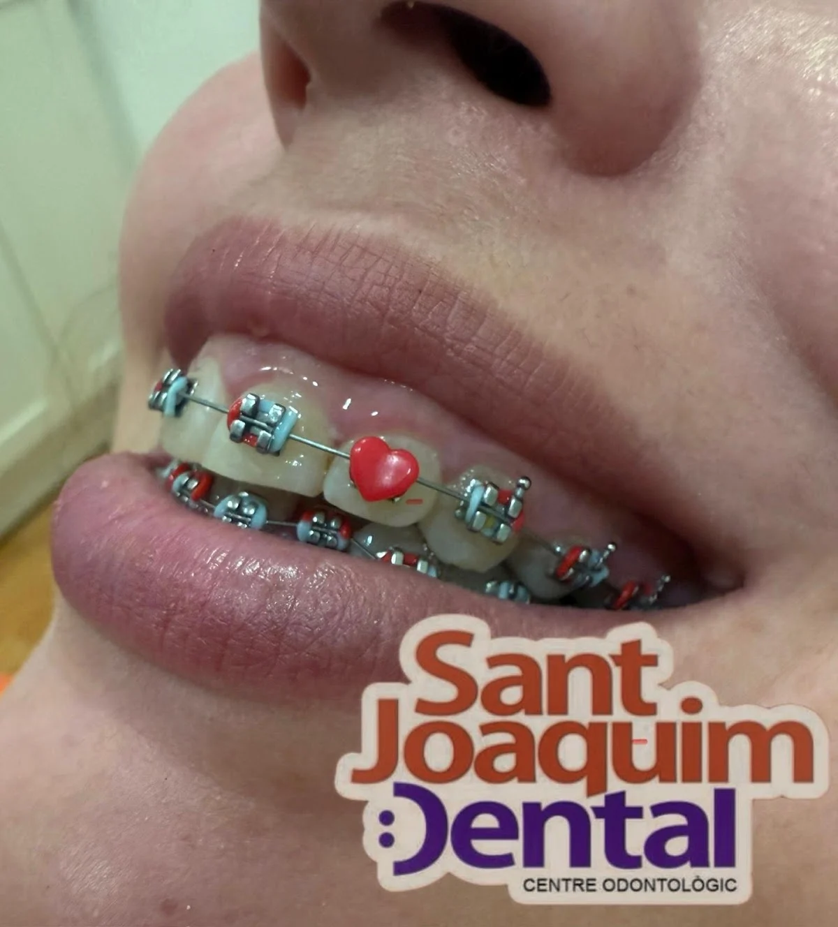 Clínica Dental Sant Joaquím