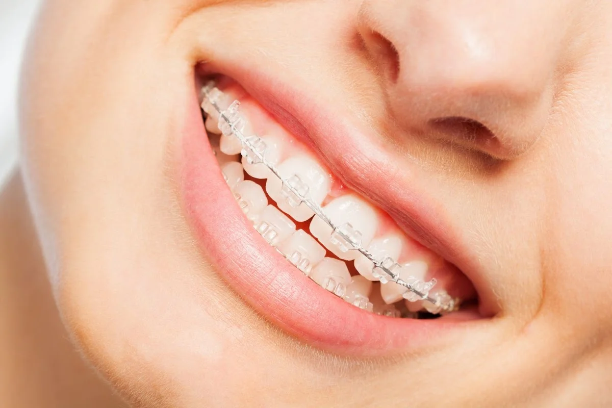 Clínica Dental Smiledent Cáceres - 2