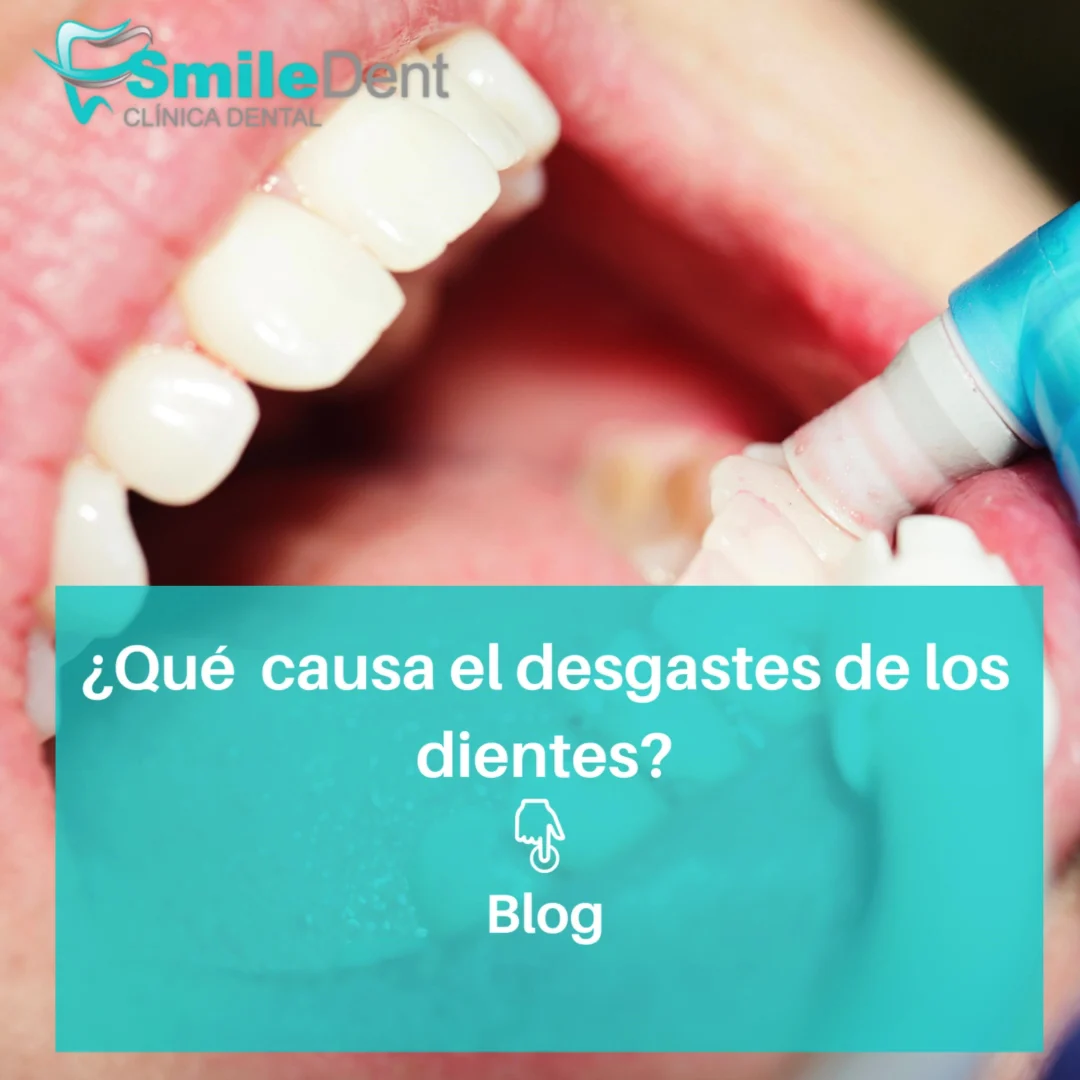 Clínica Dental SmileDent Pinto
