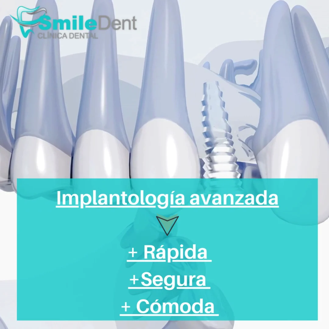 Clínica Dental SmileDent Plasencia - 3