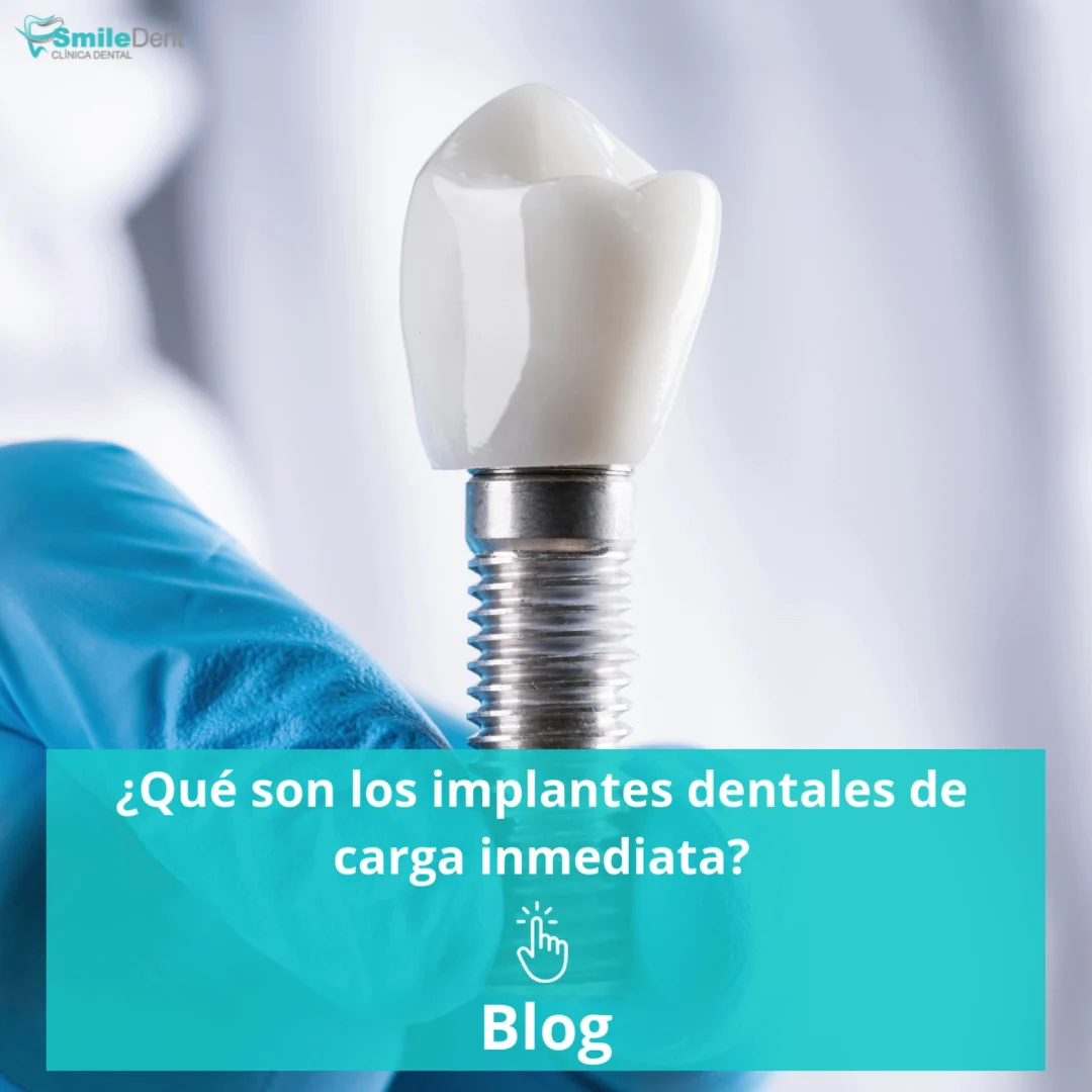 Clínica Dental SmileDent Villalba - 3