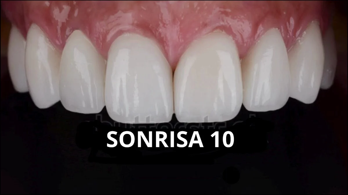 Clínica Dental Sonrisa 10 - 4